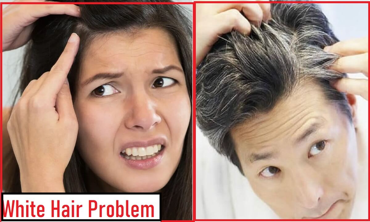 what causes white hair at early age in hindi